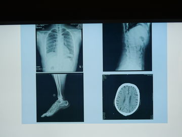 Filme da imagem latente médica de Konida X Ray impermeável para a impressora de Agfa