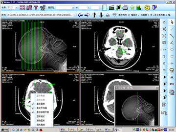 8 imagem latente diagnóstica médica do laser X Ray do papel de x 10inch para KND-DRYTEC 4000