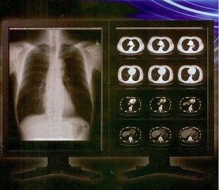 Filme claro brilhante de X Ray de Digitas, filme médico da transparência do laser de Konida