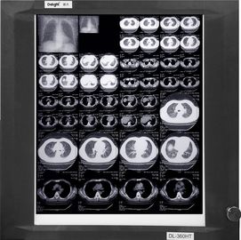 Filmes médicos baixos brancos Wearable de X Ray, filme do papel do raio X da imagem latente médica