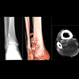 Filmes médicos baixos brancos Wearable de X Ray, filme do papel do raio X da imagem latente médica