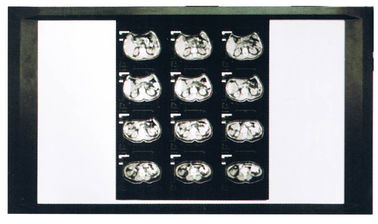 Filme seco diagnóstico do laser X Ray médico para a impressora de AGFA/Fuji