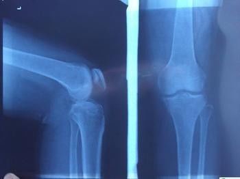 Imagem latente diagnóstica azul de X Ray, filme fotográfico do raio X médico do papel do laser