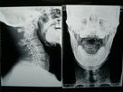 Raio X seco médico de Digitas do filme da imagem latente de Konida para impressoras de Fuji/Agfa