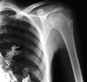 Filme de raio X médico de Agfa/Fuji, filme portátil da impressora a laser da radiografia