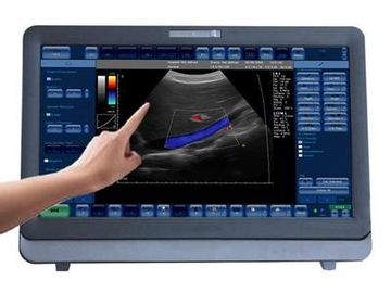 Portable médico do sistema do ultrassom de Doppler da cor 3D/4D com o monitor do diodo emissor de luz de 15 polegadas