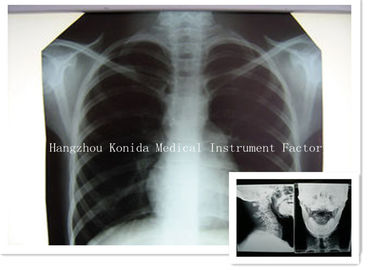 Da imagem latente seca médica da saúde do filme 14 x 17inch de X Ray de Digitas filme radiográfico