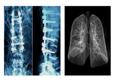 Filmes médicos radiográficos afiados de X Ray, filme do Dr. Ct Digital Seco Imagem latente de Mri