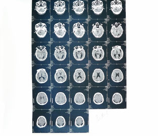 Imagem latente diagnóstica de papel médica da impressora a laser X Ray para o hospital