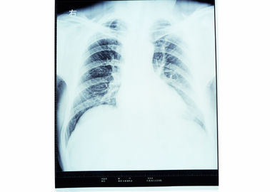 Do filme seco médico de X Ray da caixa impressora térmica para AGFA 14in x 17in