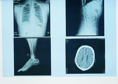 Imagem latente diagnóstica durável de X Ray, filme azul de X Ray do laser do papel médico de 32cm x de 43cm