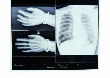 Baixa névoa filme seco da impressora térmica da transparência do raio X da imagem latente médica de 14in * de 17in
