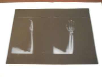 Filme seco médico da imagem latente da baixa névoa de KND-A para o exame de X Ray no × 14in de AGFA 5300 11in