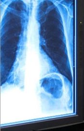 Filme seco 11in x 17in da imagem latente médica do raio X azul para a impressora térmica