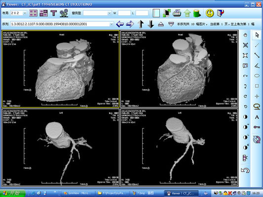 Bom preço Alogenuro de prata da imagem latente diagnóstica da impressora a laser X Ray para KND-DRYTEC 4000 on-line