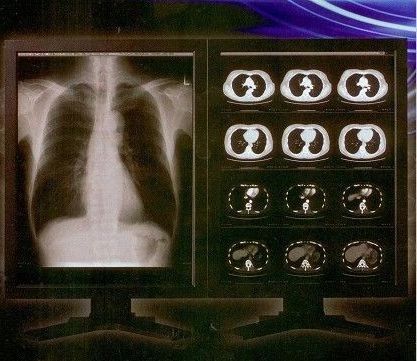 Bom preço Filme claro brilhante de X Ray de Digitas, filme médico da transparência do laser de Konida on-line
