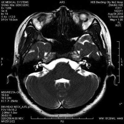 Bom preço Waterproof o filme seco holográfico KND-A para a impressora térmica, AGFA 5300 de X Ray/5500/5302 on-line