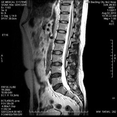 Bom preço Umidade - filme seco médico rígido 8in x 10in de X Ray da prova para a impressora térmica on-line
