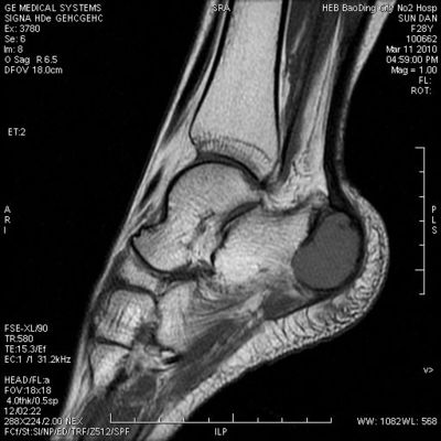 Bom preço Filme seco médico da imagem latente da densidade máxima alta de KND-A compatível com impressoras térmicas on-line
