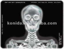 Bom preço Filme para impressora térmica de raios X médica KND-F25*30cm on-line