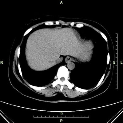 Bom preço Papel azul do laser da imagem latente diagnóstica fina de Konida X Ray para a máquina de raio X on-line