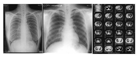 Bom preço tom brilhante do filme da impressora térmica de 14 x 17 polegadas com dupla camada on-line