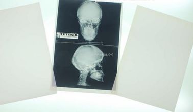 Good price Konida 10in x 12in X Ray Medical Imaging on-line