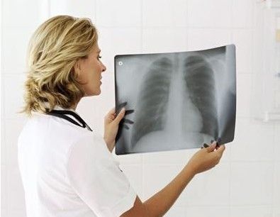 Bom preço 20cm x 25cm X Ray Diagnostic Imaging on-line