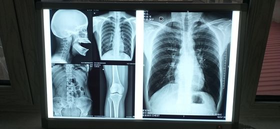 Bom preço Do filme médico do Inkjet da tela de seda superfície lustrosa impermeável on-line