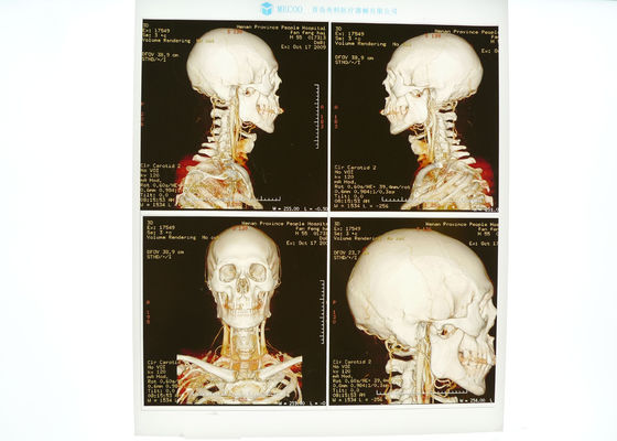 Bom preço Azul médico high-density do filme de X Ray para a impressora a laser de Konida on-line