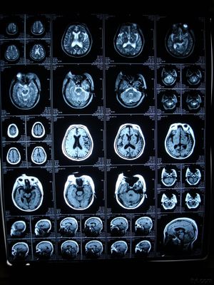 Bom preço Konida feito-à-medida raio X médico de Digitas filme seco da imagem latente para a impressora de AGFA/Fuji on-line