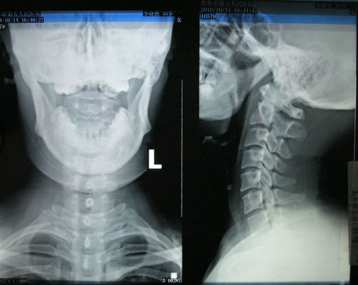 Bom preço filme seco médico lustroso da imagem latente de 35cm * de 43cm para Fuji 3000, 2000, 1000, impressora térmica on-line