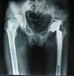 Bom preço Filme seco médico 28cm * 35cm da imagem latente de Konida da baixa base azulada do poliéster da névoa para a impressora térmica on-line