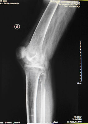 Bom preço Filme seco médico KND-A da imagem latente da agudeza alta para AGFA 5300, 5302, 5500, 5502, 3000 on-line