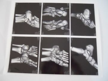 Bom preço Filme seco médico da imagem latente para o exame de X Ray em AGFA 5300, 5302, 5500 on-line