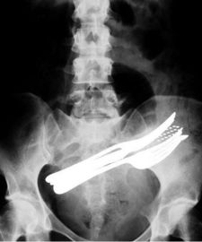 Bom preço filme seco KND-A transparente da imagem latente médica do raio X de 11in x de 14in para AGFA on-line