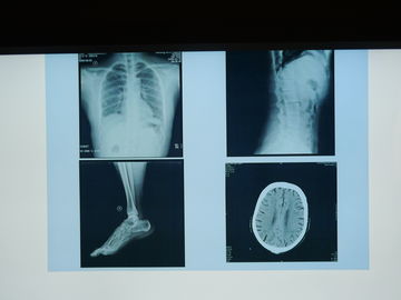 Good price Filme da imagem latente médica de Konida X Ray impermeável para a impressora de Agfa on-line