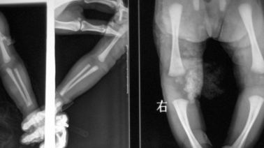 Good price imagem latente médica do laser X Ray de 20 x de 25cm, filme de DT1B/DT2B Agfa X Ray on-line