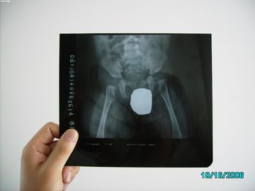 Good price Imagem latente médica de prata Agfa fino impermeável DRYSTAR DT1B/DT2B do laser X Ray do alogenuro on-line