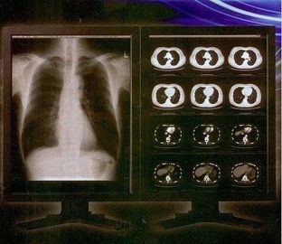 Good price Filme claro brilhante de X Ray de Digitas, filme médico da transparência do laser de Konida on-line