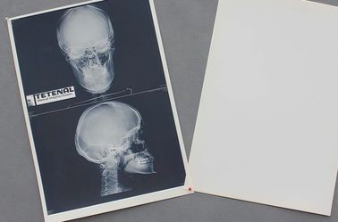 Good price Agudeza alta impermeável do filme de papel médico branco da caixa X Ray on-line