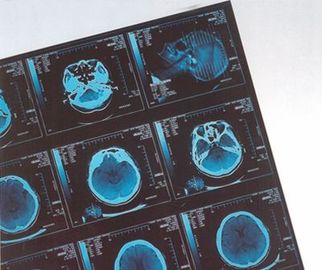 Good price Thermal seco médico do filme de X Ray de Digitas para o CR do hospital/Dr. on-line