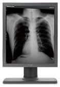 Good price 4096 exposições G51SP da categoria médica de escala cinzenta têm cinco milhão pixéis on-line