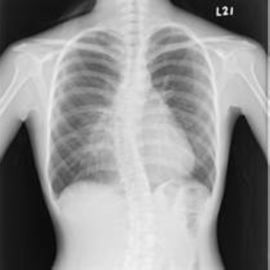 Good price KND-A/filmes médicos X Ray de F on-line
