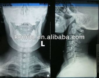 Good price Imagem latente diagnóstica médica da agudeza alta, filme seco de AGFA X Ray on-line