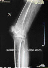 Good price Imagem latente diagnóstica durável de X Ray, filme azul de X Ray do laser do papel médico de 32cm x de 43cm on-line