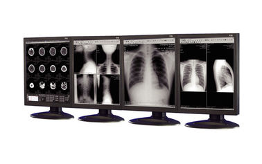 Good price exposições Anti-reflexivas da categoria médica usadas no equipamento da imagem latente médica on-line