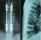 Good price Filme seco afiado de X Ray de Digitas radiológico para Fujifilm Instax 2000 on-line