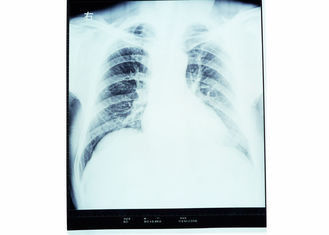 Good price Filme seco da imagem latente de Konida, filme médico da imagem latente do laser do papel on-line