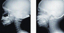Imagem latente diagnóstica alta da cobertura X Ray da tinta, filme médico do raio de x do laser de 35 x de 43cm
